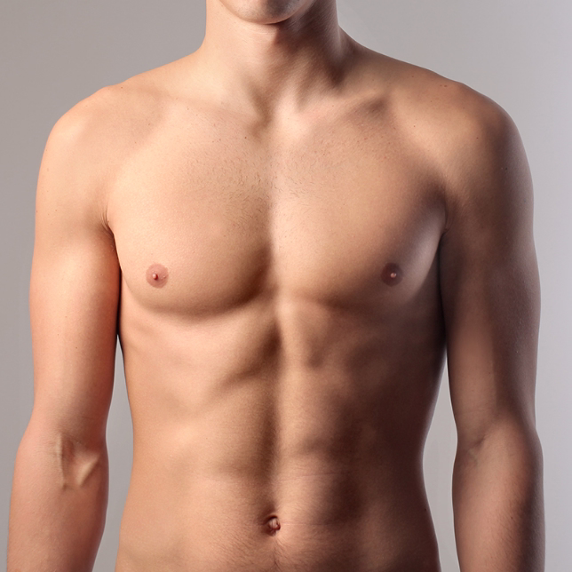 Abdominoplastia masculina Bogotá - Antes y después