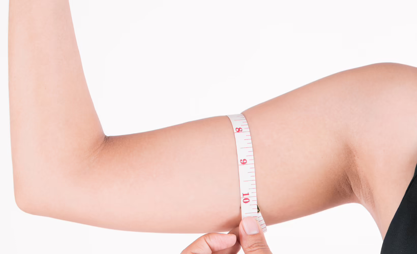 Valoración y medición del brazo antes de definir la posición de la cicatriz — Dr. Hermes Gamba Medición del brazo en consulta de braquioplastia — Dr. Hermes Gamba