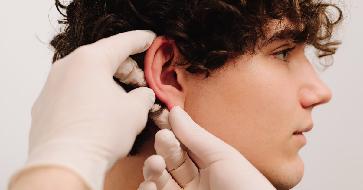 Examen de candidato joven para otoplastia — Dr. Hermes Gamba Colombia