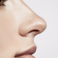 Tipos de rinoplastia — abierta, cerrada y ultrasónica — Dr. Hermes Gamba Colombia
