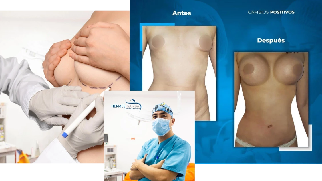Dr. Hermes Gamba, cirujano plástico en Colombia
