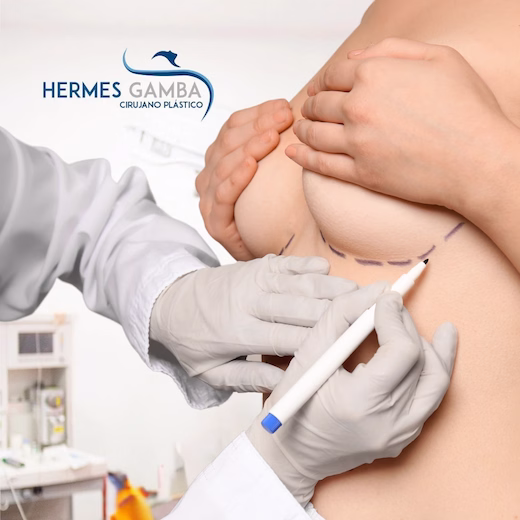 Dr. Hermes Gamba cirujano plástico Bogotá