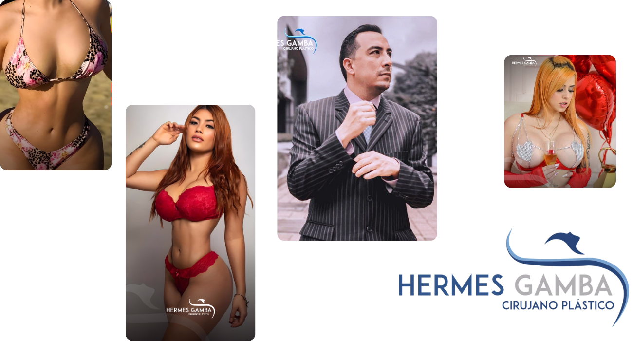 Mamoplastia de aumento con implantes MOTIVA en Bogotá