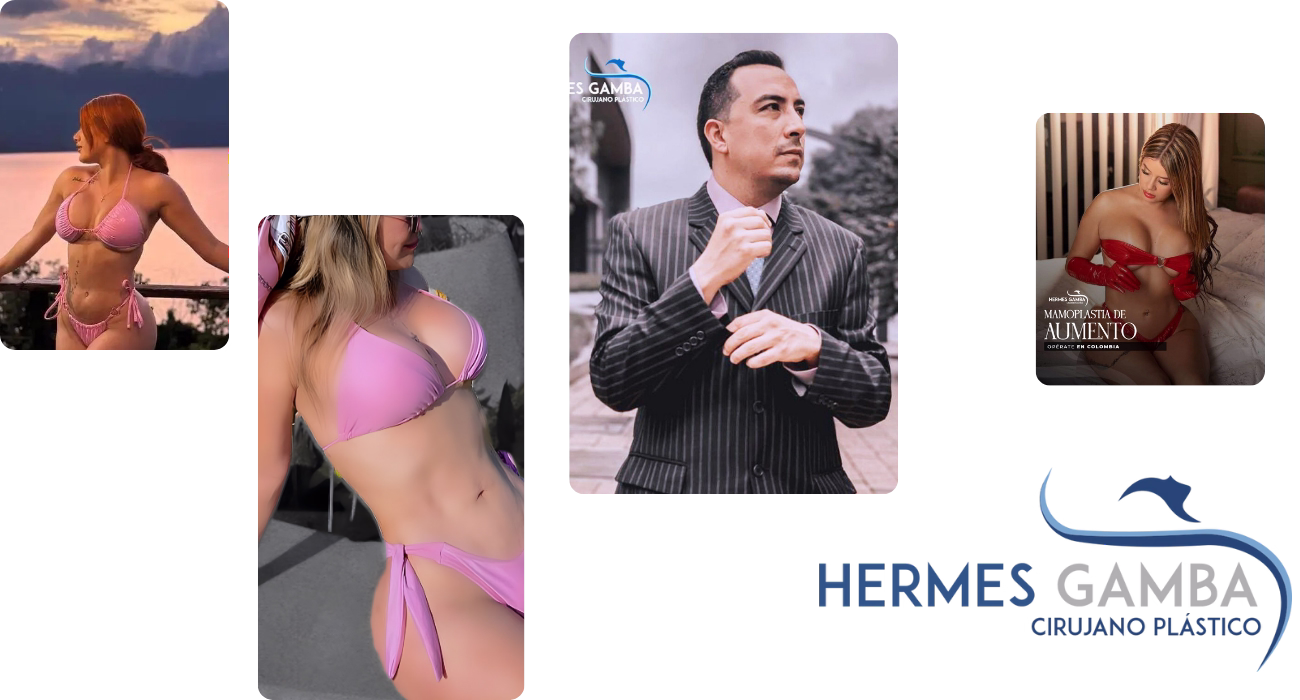 Casos de Cali, Medellín y Barranquilla sobre mamoplastia con el cirujano Hermes Gamba
