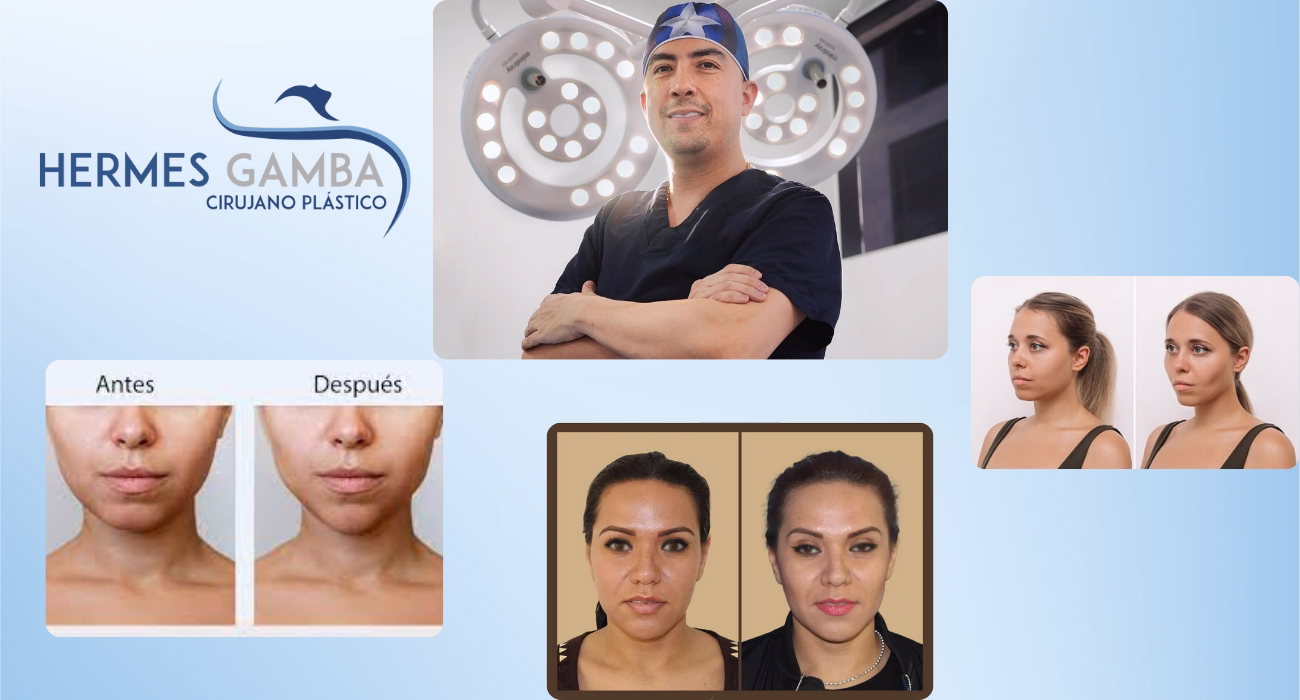 Proceso bichectomía conservadora