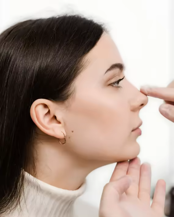 Resultados de rinoplastia estética y funcional por Dr. Hermes Gamba en Bogotá